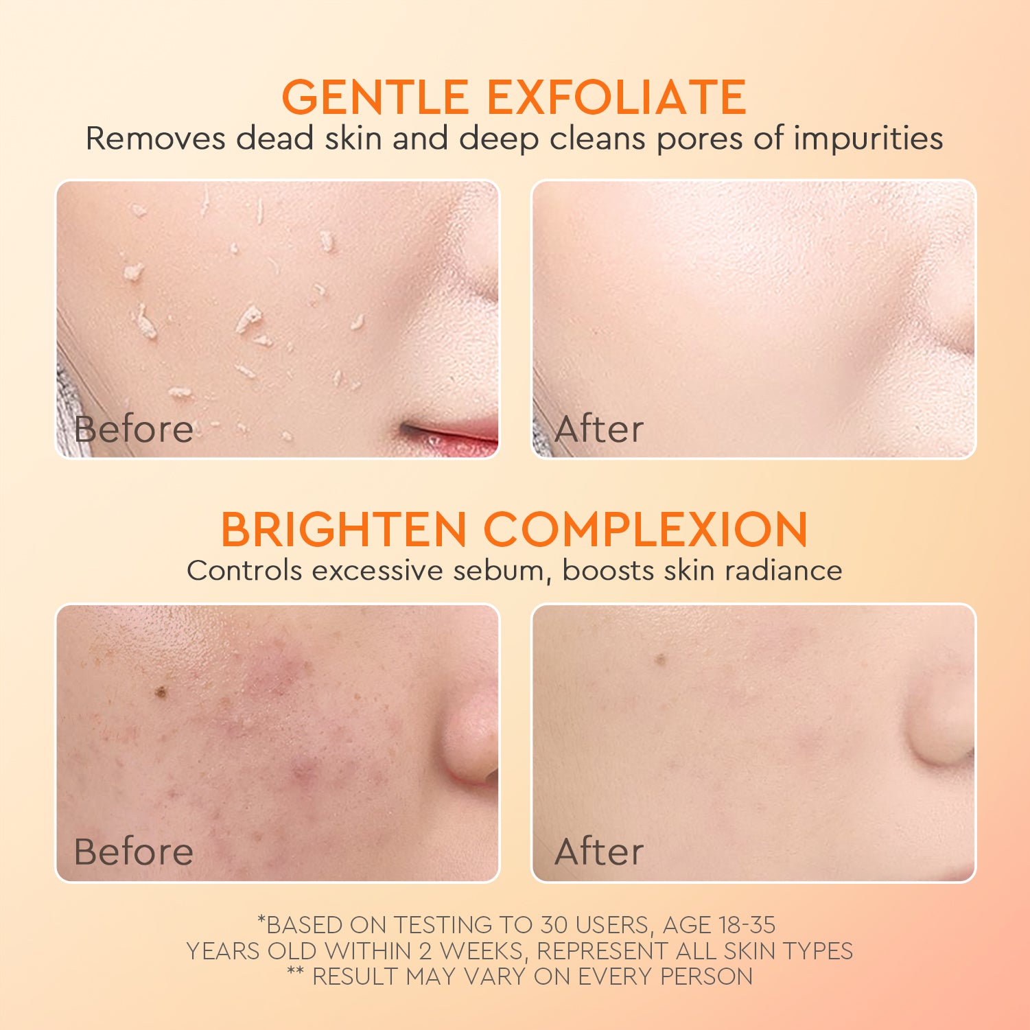Apricot Glycolic Acid Exfo Smooth Peeling Gel
