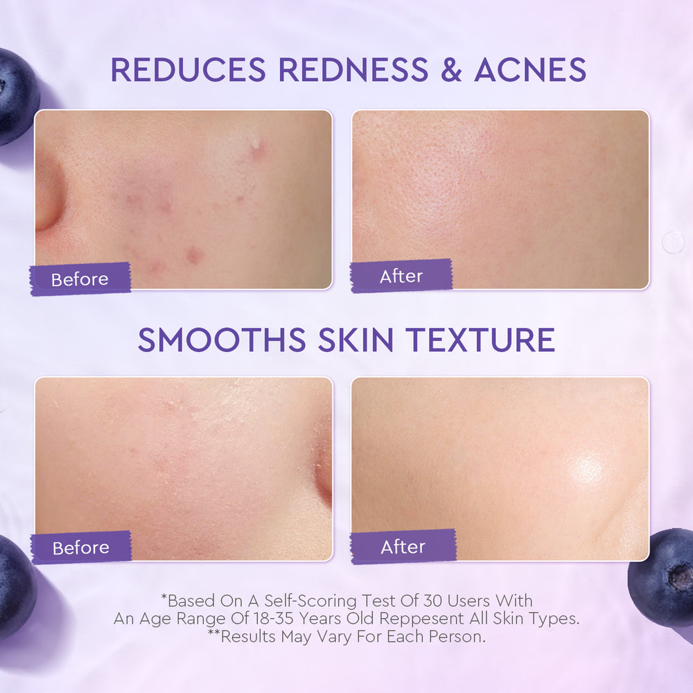 Blueberry Ceramide Barrier Moisturizer