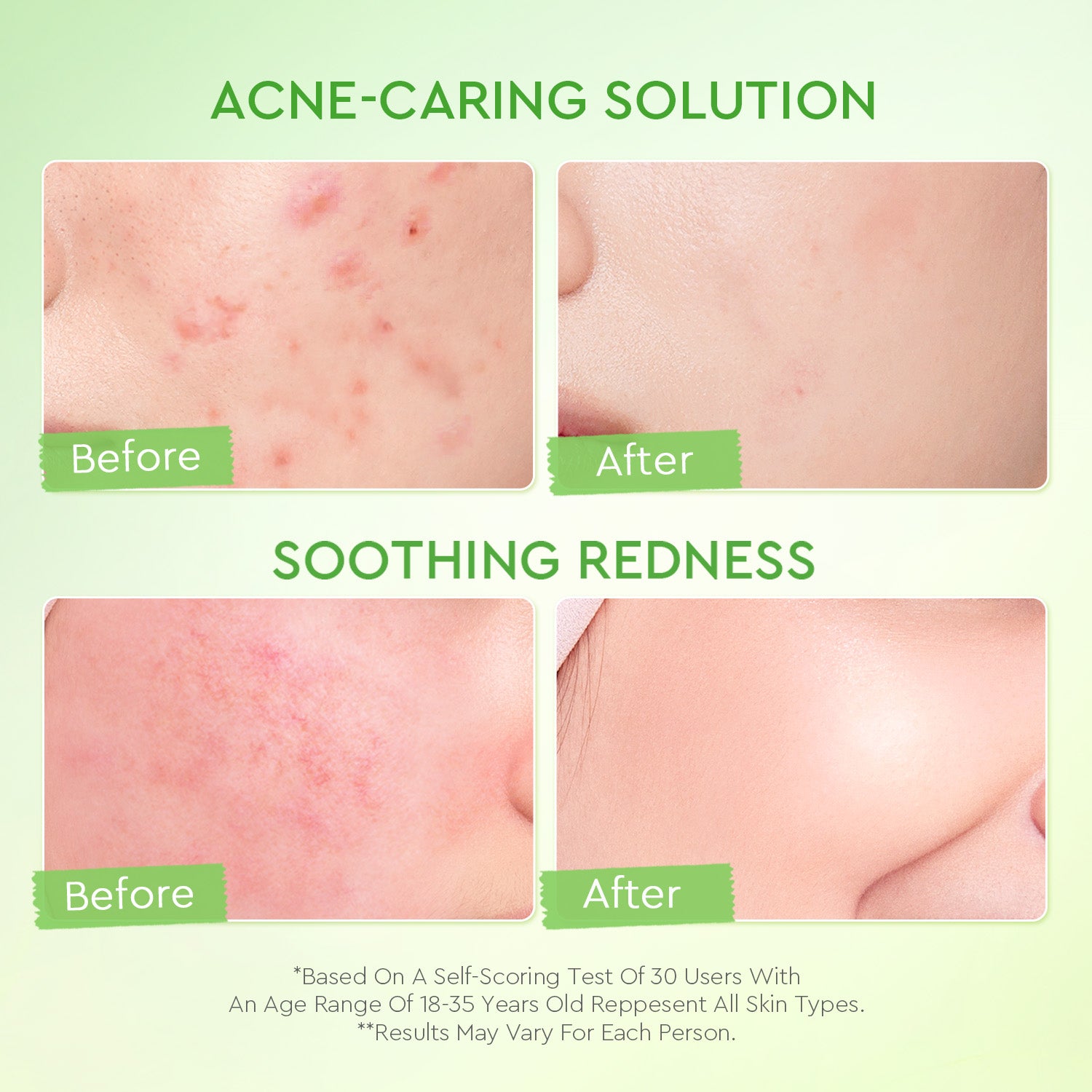 Kiwi 3D Acid Moisturizer