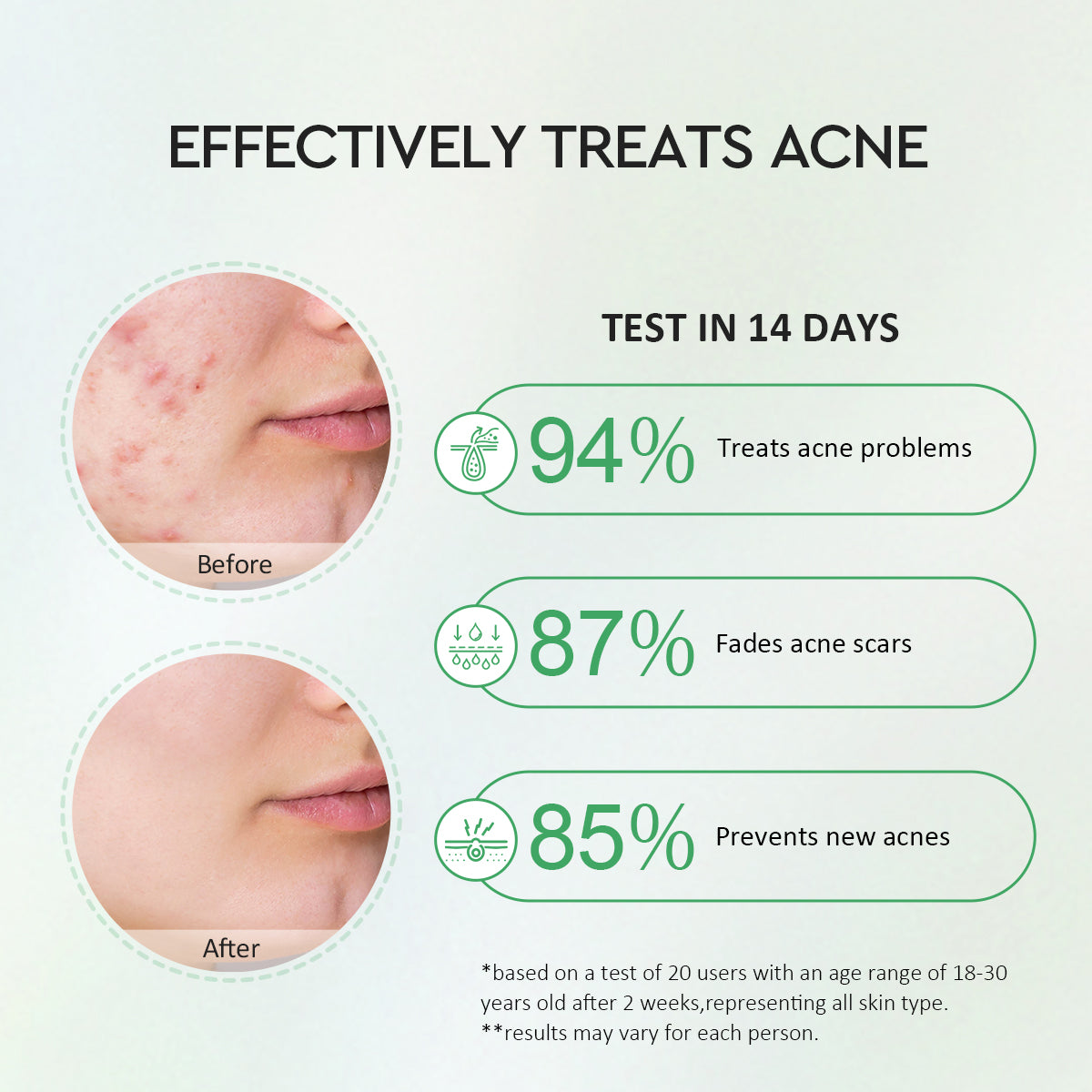Centella 2% Salicylic Acid Power Clear Acne Serum