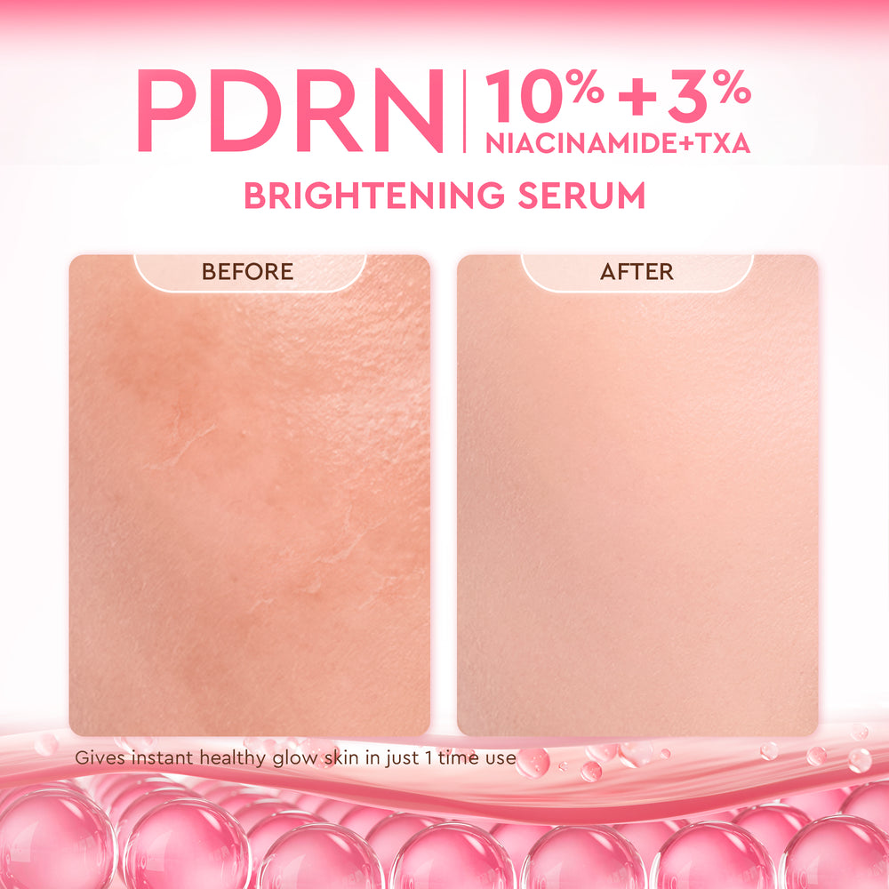 Pdrn 10% Niacinamide 3% Txa Brightening Serum