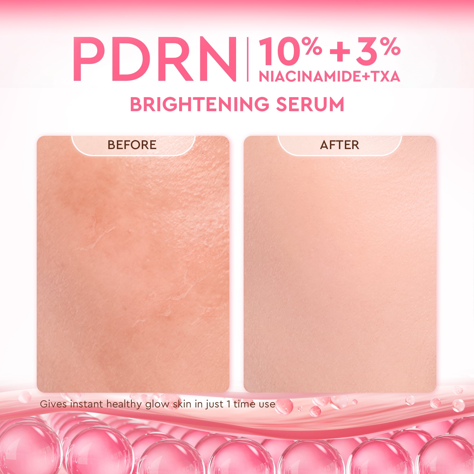 Pdrn 10% Niacinamide 3% Txa Brightening Serum